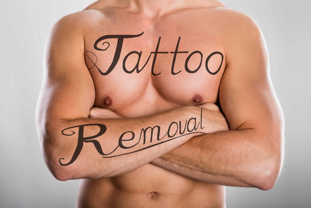Tattoo Removals Facts Cost Risks and More