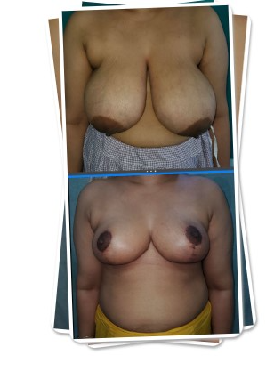 result image