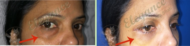 result image