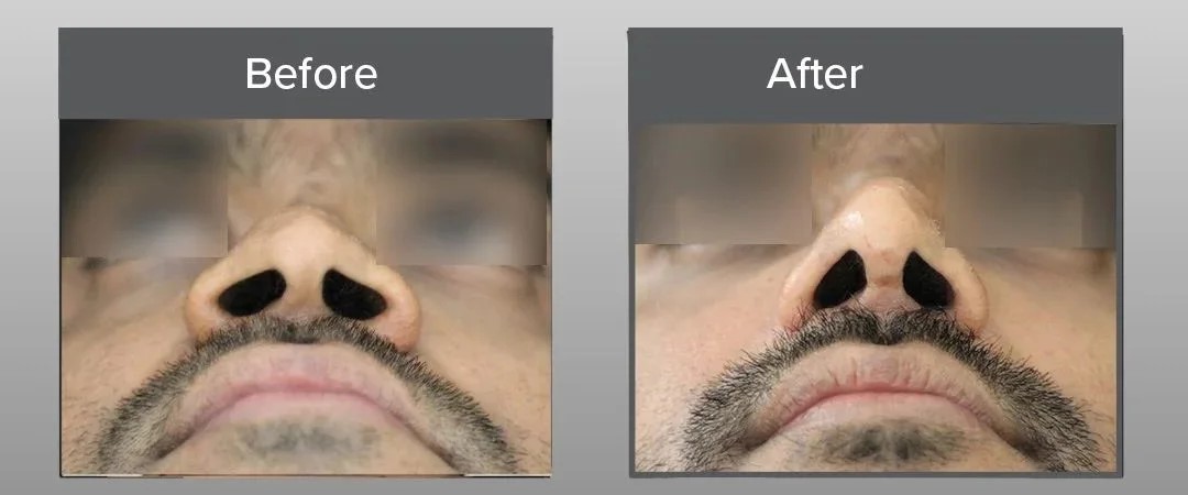 result image