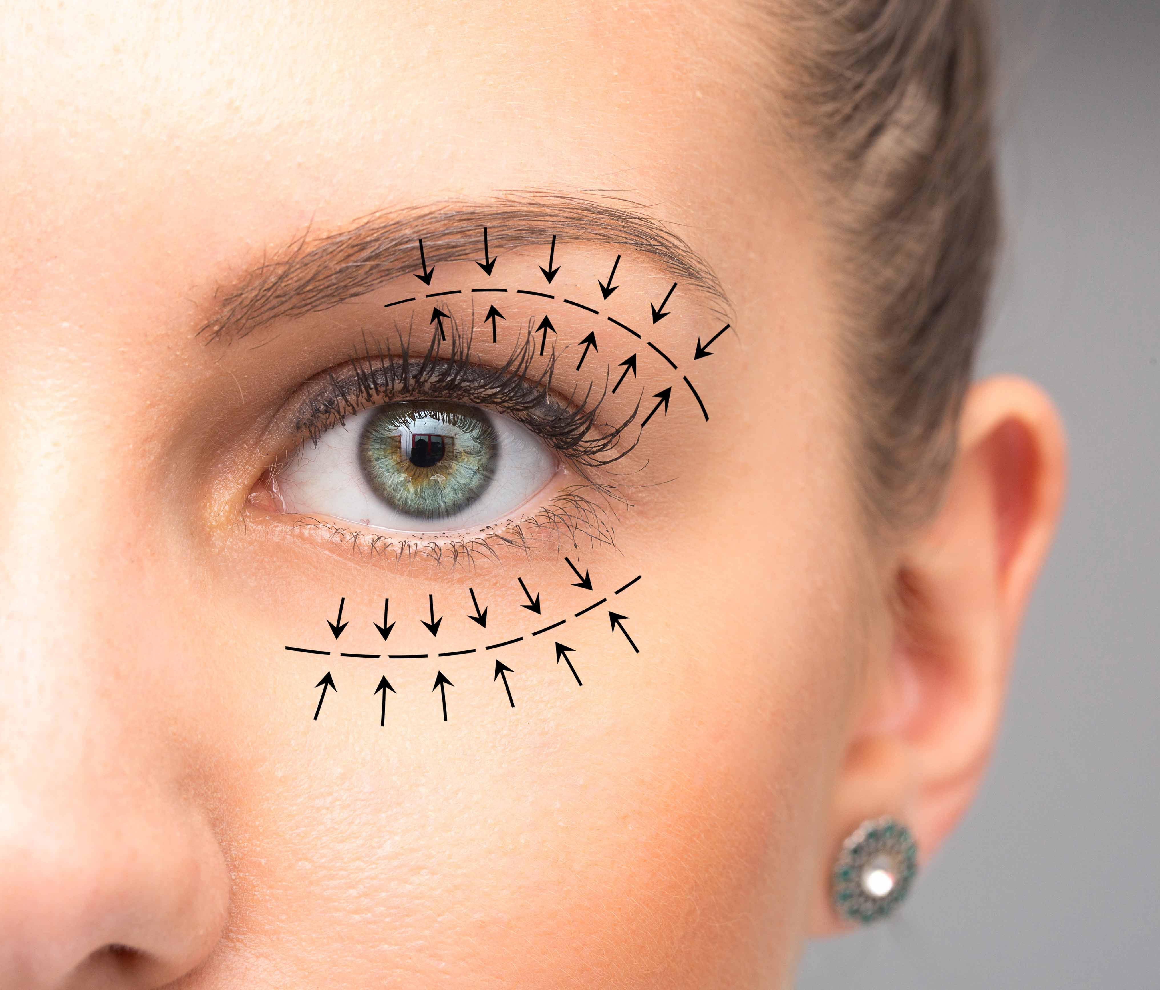 Top 10 Blepharoplasty Facts to Know Before Going under the Knife