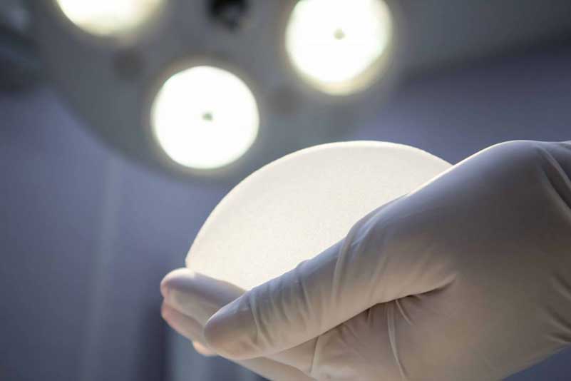 Breast-Implant-Removal-2