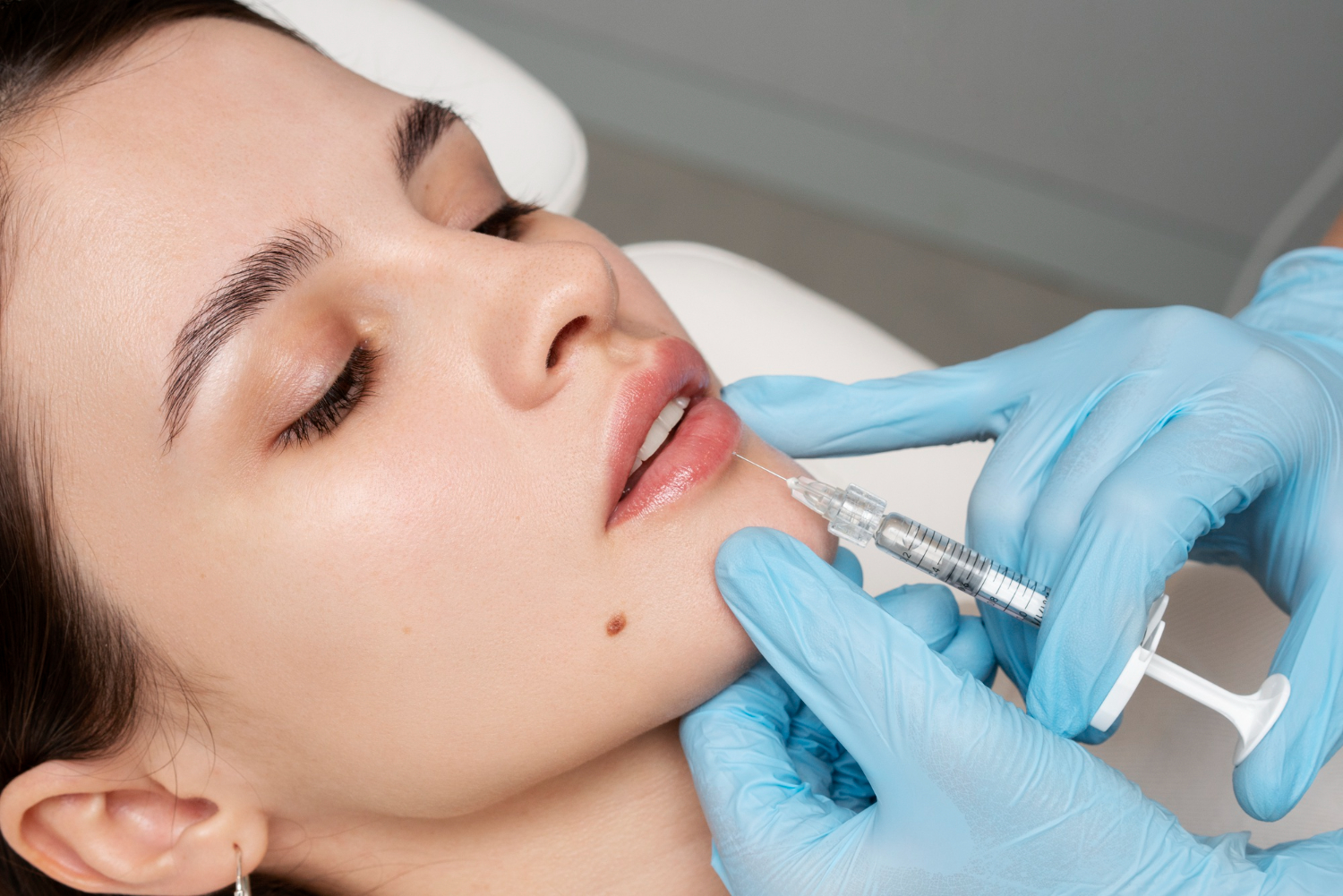 Permanent Lip Augmentation – Methods And Misconceptions