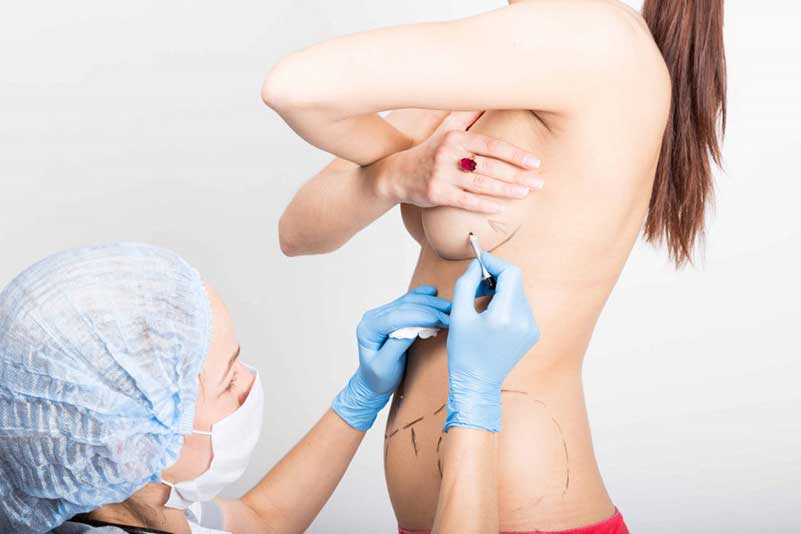 Breast Lift treatment in india, Mastopexy