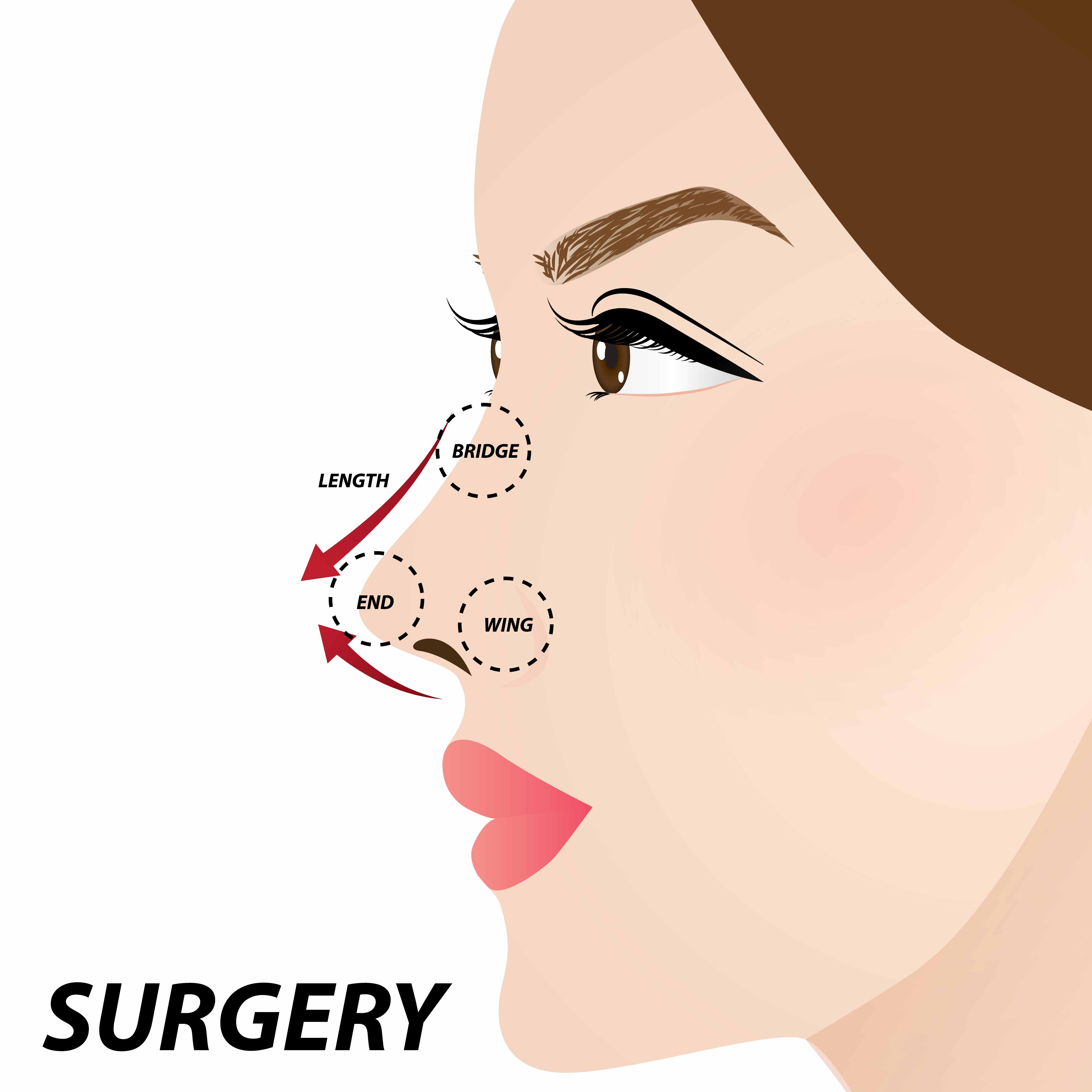 Plastic Surgery